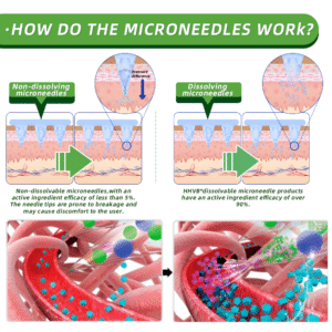 HHVB® Nano Microneedle Patch with SMGT-GLP-1 11 HHVB® Nano Microneedle Patch with SMGT-GLP-1
