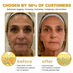 ADNOON™ Botox & Bee Venom Skin Treatment Cream