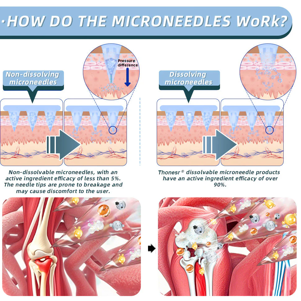 Thonesr® Nano-microneedle joint patch 7 Thonesr® Nano-microneedle joint patch