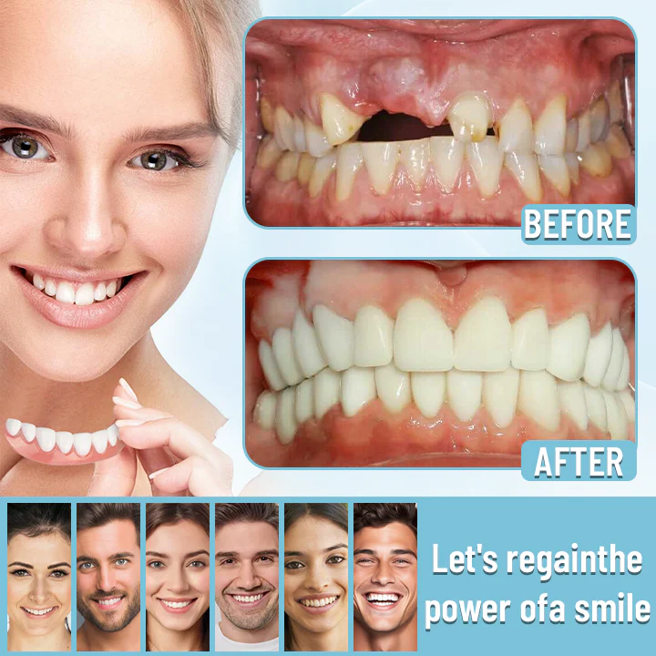 Bikenda® Official Store Advanced Full Denture Set 6 Bikenda® Official Store Advanced Full Denture Set - Image 6