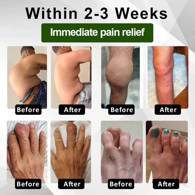 Fivfivgo™ Emu Oil JointRelief Ointment 3 Fivfivgo™ Emu Oil JointRelief Ointment