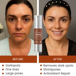 Oveallgo® Korean HerbErase Reedle Shot 100 Black Cumin Seed Oil Dark Spot Peel-Off Facial Mask 7 Oveallgo® Korean HerbErase Reedle Shot 100 Black Cumin Seed Oil Dark Spot Peel-Off Facial Mask