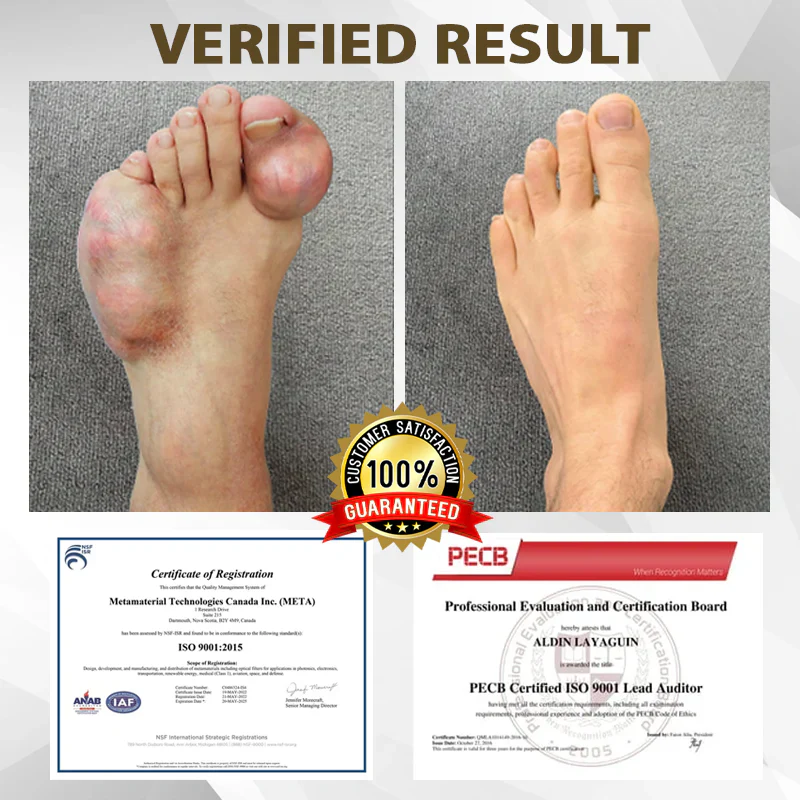 Fivfivgo™ Emu Oil JointRelief Ointment 4 Fivfivgo™ Emu Oil JointRelief Ointment