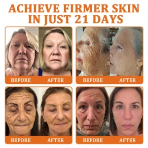 Flysmus™ Botox Bee Venom Treatment Serum Stick 15 Flysmus™ Botox Bee Venom Treatment Serum Stick