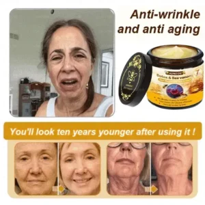 ADNOON™ Botox & Bee Venom Skin Treatment Cream