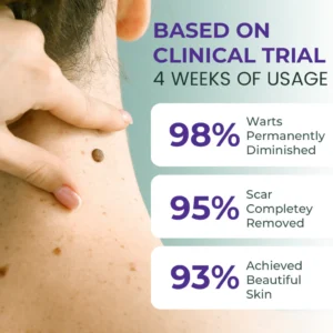 Oveallgo® Ultra Clarivine Dissolver Mole & Dark Spot Removal Bio-Gel