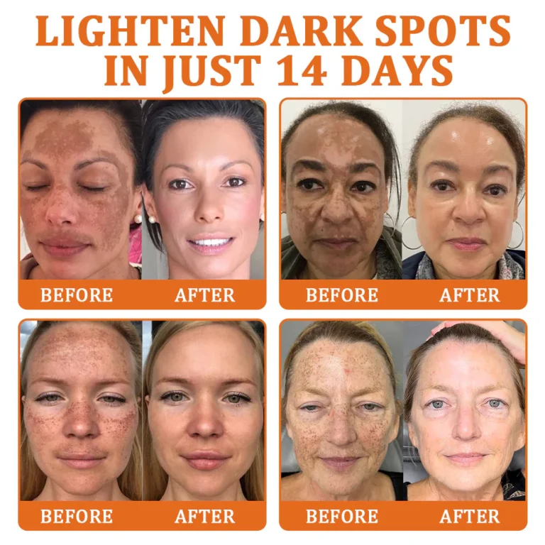 Flysmus™ Botox Bee Venom Treatment Serum Stick 3 Flysmus™ Botox Bee Venom Treatment Serum Stick