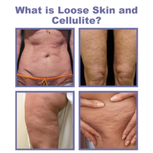 Oveallgo™ Slimming Invisible Leg Lift