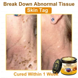 ADNOON™ Botox & Bee Venom Skin Treatment Cream