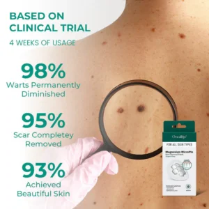 Oveallgo® Magnesium MicroPin Target & Clear Wart Removal Patch