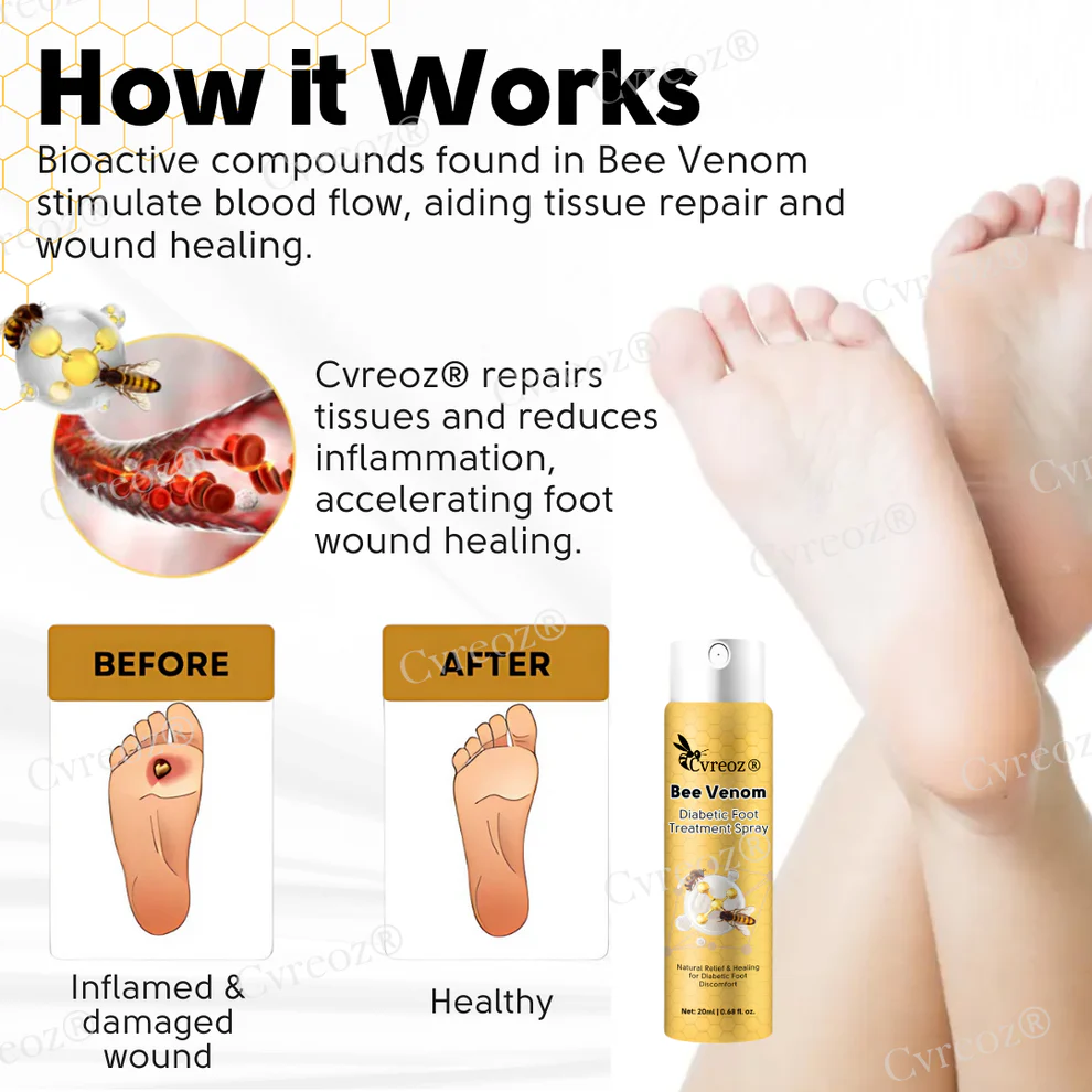 Cvreoz® Bee Venom Diabetic Foot Treatment Spray 6 Cvreoz® Bee Venom Diabetic Foot Treatment Spray