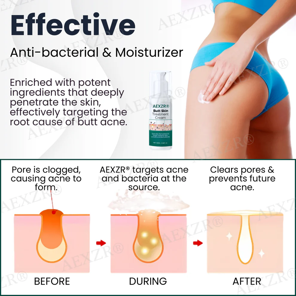 AEXZR® Butt Skin Treatment Cream 6 AEXZR® Butt Skin Treatment Cream