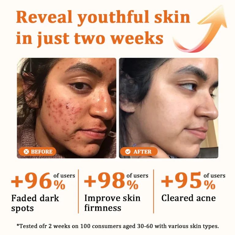 Flysmus™ Botox Bee Venom Treatment Serum Stick 8 Flysmus™ Botox Bee Venom Treatment Serum Stick