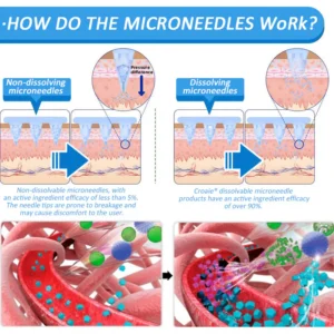 CROAIE® Nail Fungus Care Patches® Nano Microneedle Patch 17 CROAIE® Nail Fungus Care Patches® Nano Microneedle Patch with SMGT-GLP-1