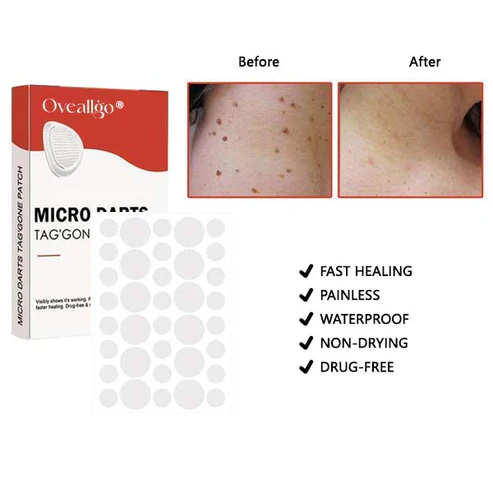 Oveallgo® MicroDart Skin Tag Remover Patch 3 Oveallgo® MicroDart Skin Tag Remover Patch