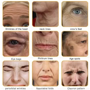 ADNOON™ Botox & Bee Venom Skin Treatment Cream