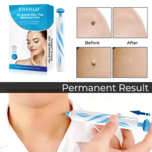 Fivfivgo™ At-home Skin Tag Removal Pen 7 Fivfivgo™ At-home Skin Tag Removal Pen