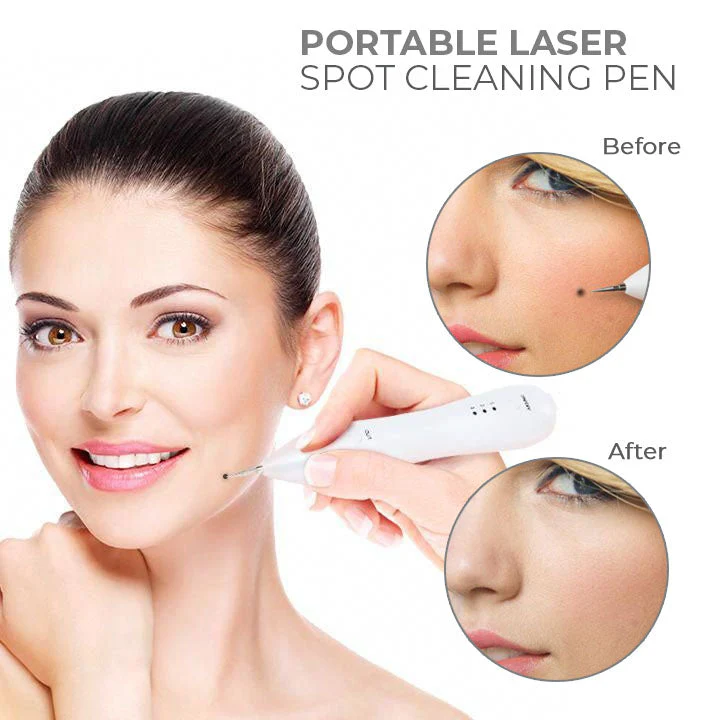 Fivfivgo™ Portable Laser Spot Cleaning Pen 2 Fivfivgo™ Portable Laser Spot Cleaning Pen