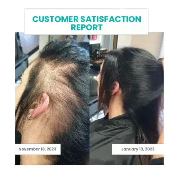 Oveallgo™ ScalpReboost NMN Hair Growth Roller 11 Oveallgo™ ScalpReboost NMN Hair Growth Roller - Image 11