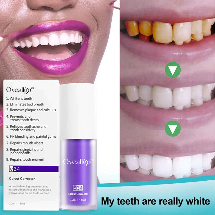 Oveallgo™ Deluxe Herbal Teeth Whitening Mousse 3 Oveallgo™ Deluxe Herbal Teeth Whitening Mousse