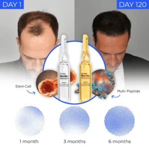 Nordic Biolabs™ STEM Cell Complete Hair Cycle Solution 2.0