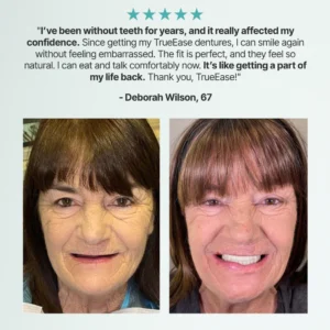 TrueEase™ Custom-Fit Functional Dentures