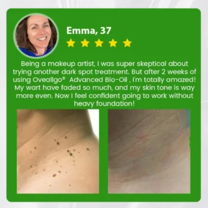 Oveallgo® Advanced Bio-Oil Mole & Spot Corrector 17 Oveallgo® Advanced Bio-Oil Mole & Spot Corrector