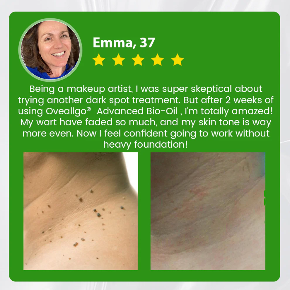 Oveallgo® Advanced Bio-Oil Mole & Spot Corrector 6 Oveallgo® Advanced Bio-Oil Mole & Spot Corrector