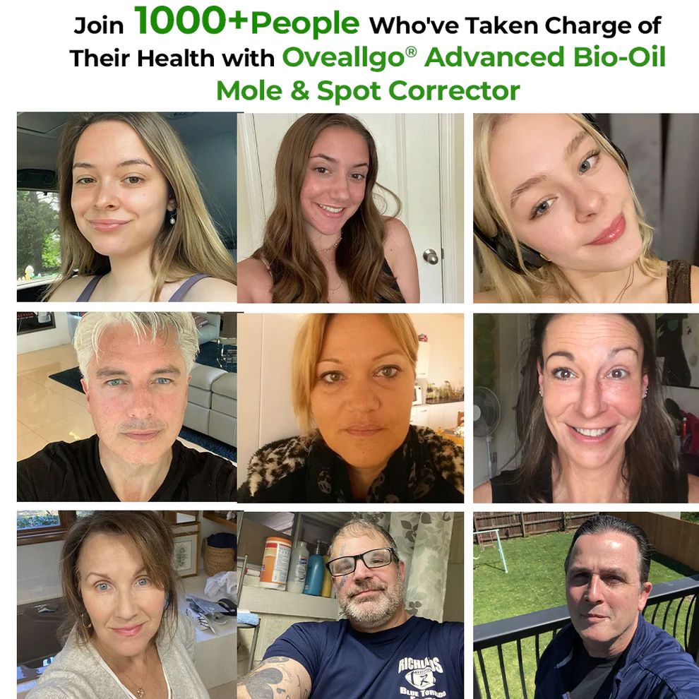 Oveallgo® Advanced Bio-Oil Mole & Spot Corrector 2 Oveallgo® Advanced Bio-Oil Mole & Spot Corrector