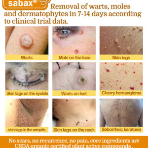 SkinClix™ | Effectively relieves itching and flaking and improves the appearance 17 SkinClix™ | Effectively relieves itching and flaking and improves the appearance