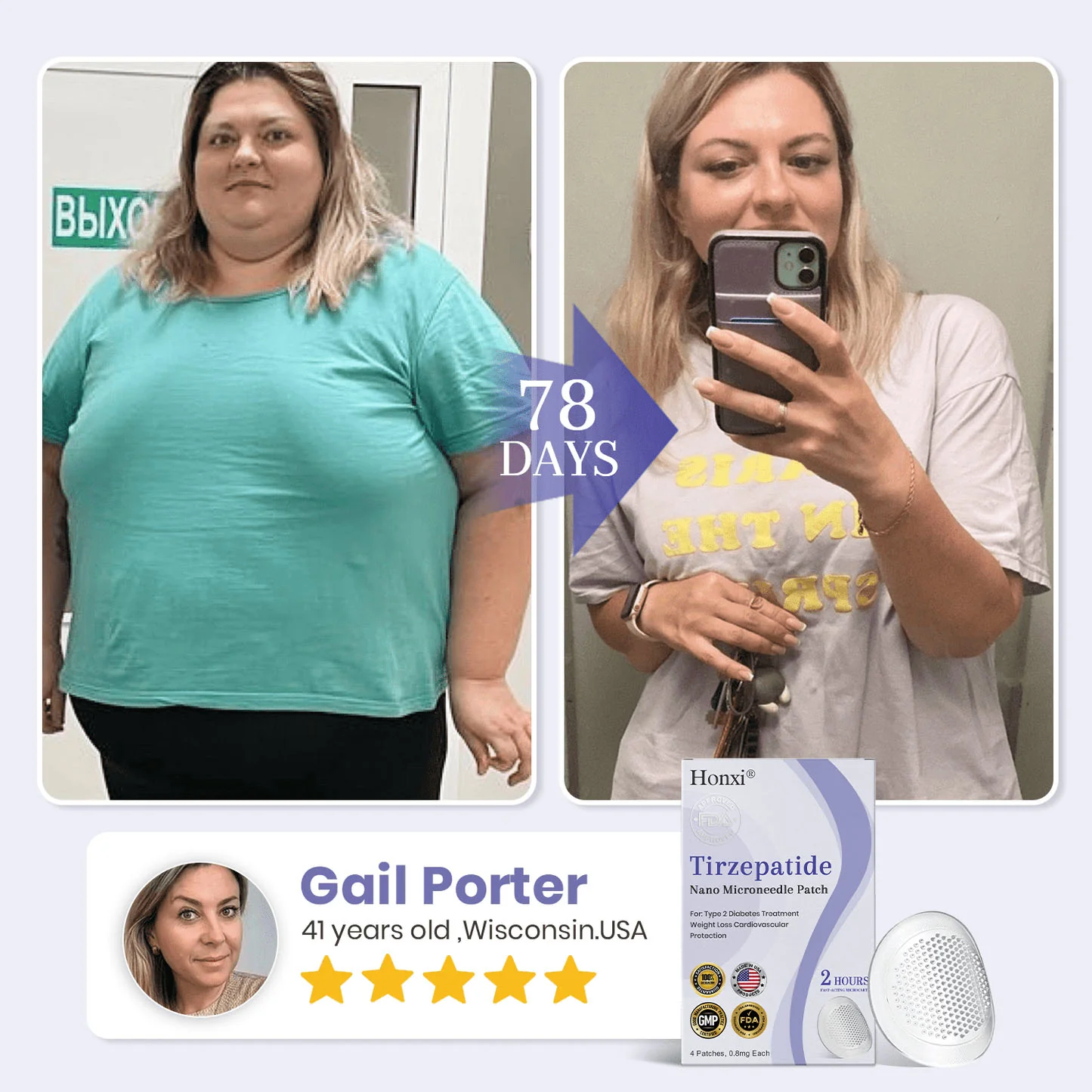 Honxi® NIDDK Tirzepatide Namo Microneedle Patch 2 Tirzepatide Namo Microneedle Patch