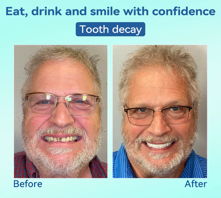 DIYSTAR™ Premium Denture 5 DIYSTAR™ Premium Denture - Image 5