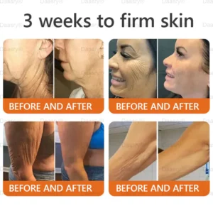Daasry® "Golden Elixir" Botox Bee Venom Skin Restoration Cream