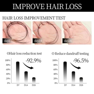 DIYSTAR™Root Activator Shampoo- Regain a full head of hair in just 6 weeks! 13 DIYSTAR™Root Activator Shampoo- Regain a full head of hair in just 6 weeks!