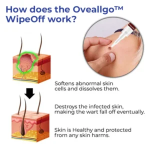 Oveallgo™ WipeOff Ultimate Tags & Moles Remover
