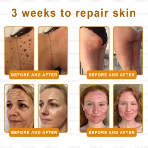 Daasry® "Golden Elixir" Botox Bee Venom Skin Restoration Cream