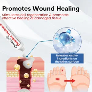 Cvreoz® Diabetes Treatment Cream 14 Cvreoz® Diabetes Treatment Cream