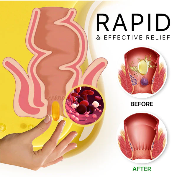 AEXZR™ Bee-Venom Hemorrhoid Capsule 5 AEXZR™ Bee-Venom Hemorrhoid Capsule - Image 5