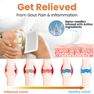 Cvreoz® Colchicine Nano-Needles Patches for Gout Care 12 Cvreoz® Colchicine Nano-Needles Patches for Gout Care