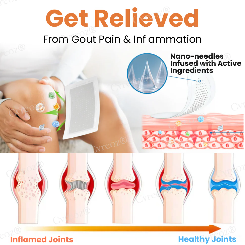 Cvreoz® Colchicine Nano-Needles Patches for Gout Care 6 Cvreoz® Colchicine Nano-Needles Patches for Gout Care