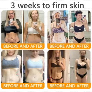 LBMLBM™ Bee venom Comprehensive Cream 13 LBMLBM™ Bee venom Comprehensive Cream