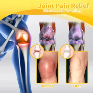 Best Deal flysmus™ Bee-Venom Pain-Relief Bone Healing Cream