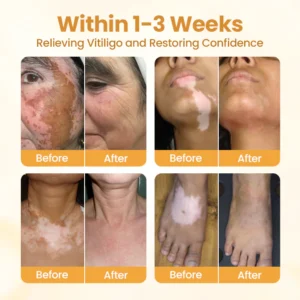 BBOJI™ VitiClear Pro Bee Toxin Cream