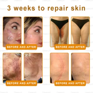 Daasry® "Golden Elixir" Botox Bee Venom Skin Restoration Cream