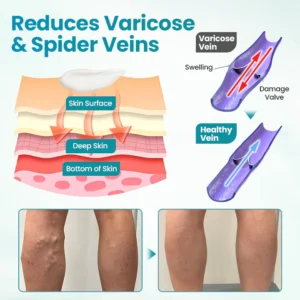 Fivfivgo® VeinEase Soothing Cream 9 Fivfivgo® VeinEase Soothing Cream