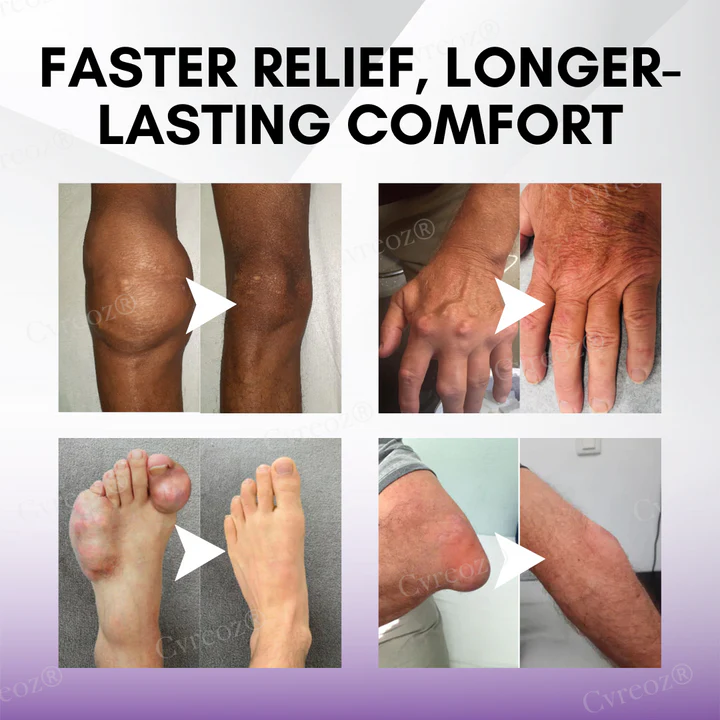 Cvreoz® Turmeric & Emu Oil Arthritis Soothing Pain Relief Massage Gel 3 Cvreoz® Turmeric & Emu Oil Arthritis Soothing Pain Relief Massage Gel