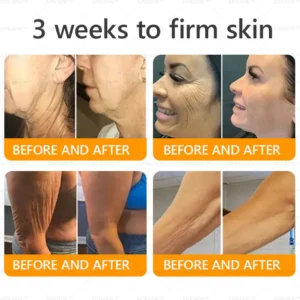 LBMLBM™ Bee venom Comprehensive Cream 12 LBMLBM™ Bee venom Comprehensive Cream