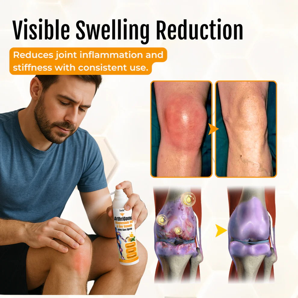 ArthriGone Magnesium Oil & Bee Venom Joint Care Spray 6 ArthriGone Magnesium Oil & Bee Venom Joint Care Spray