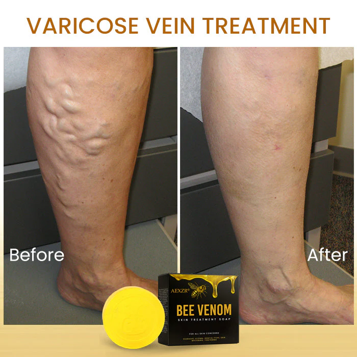 AEXZR® Bee Venom Skin Treatment Soap 10 AEXZR® Bee Venom Skin Treatment Soap