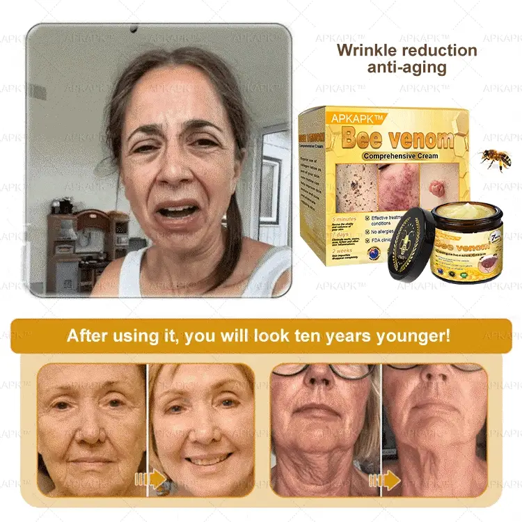 APKAPK™ Bee Venom Skin Treatment Cream 10 APKAPK™ Bee Venom Skin Treatment Cream